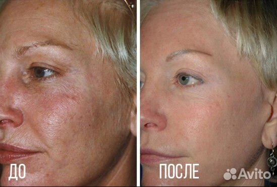 Маска очищение и омоложение