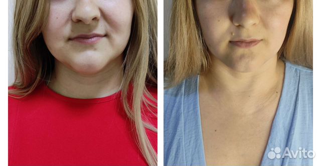 Скульптурно-буккальный массаж лица,рф,чистка лица