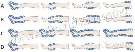 Аппарат прессотерапии AIR Press A1