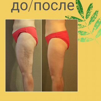 Массаж, коррекция фигуры. заводской район